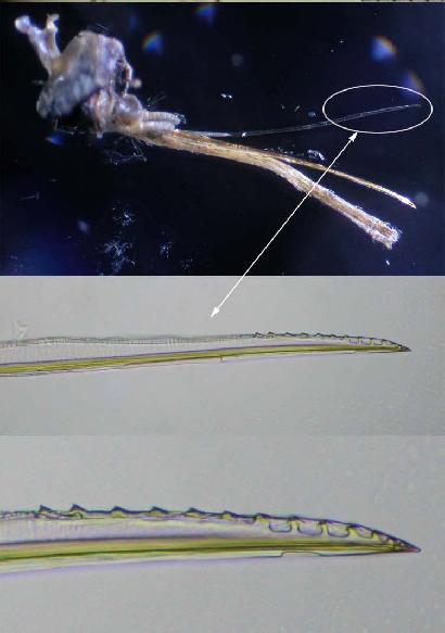 蚊の針の拡大写真。ノコギリのように先端がギザギザしている。