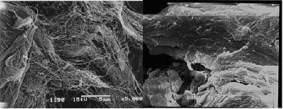 バクテリアセルロース(左)と植物セルロース(右)  バクテリアセルロース(左)のほうが繊維が細かく網目状であることが分かる