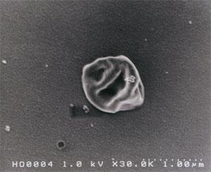代表的な古細菌　Sulfolobus sp.